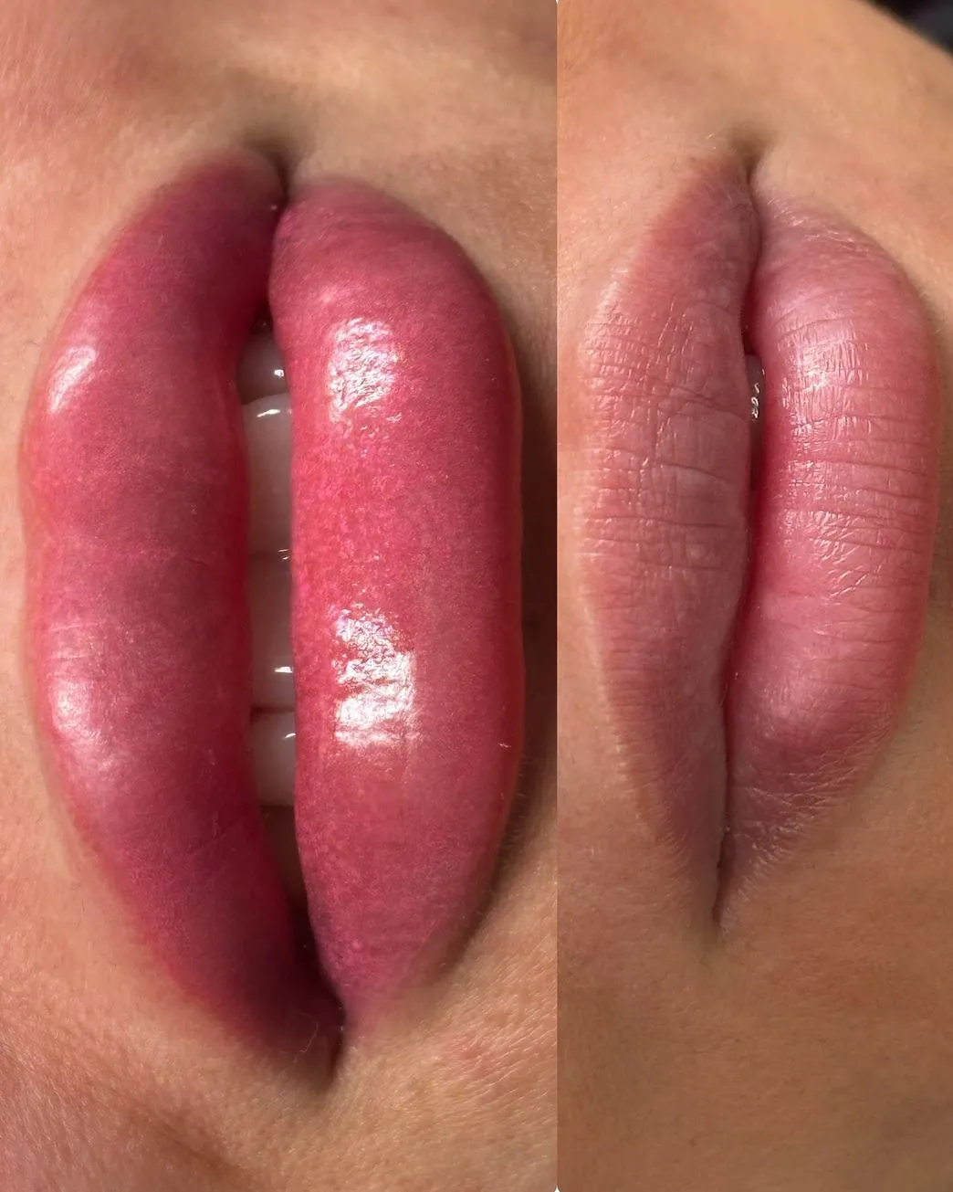 Can I drink coffee after a lip tattoo