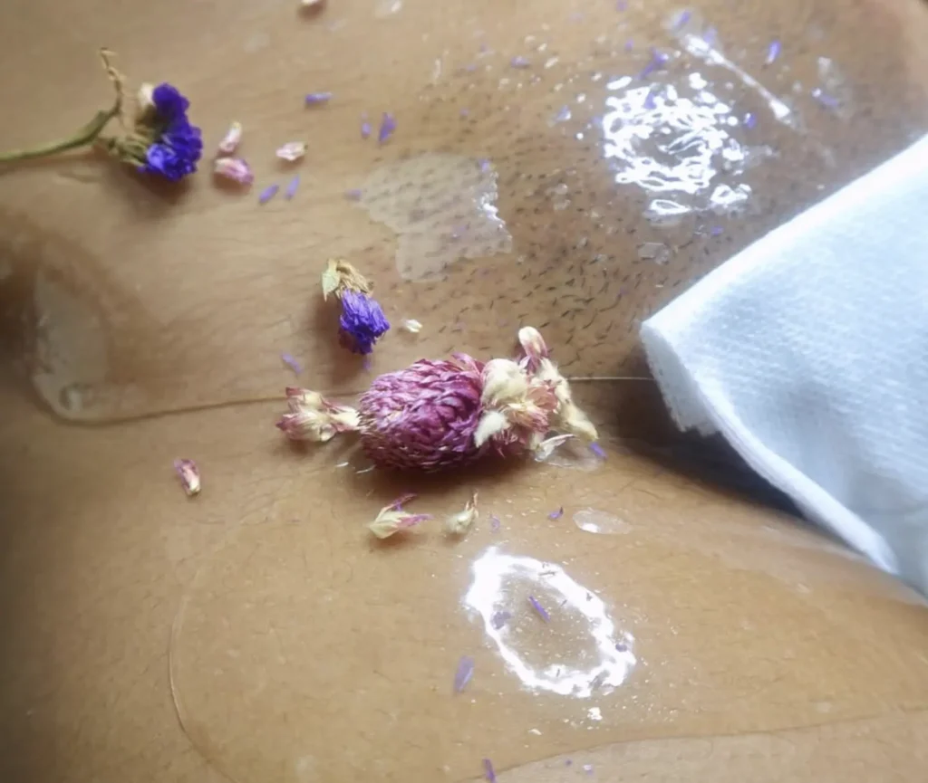 Is it good to laser your bikini area?