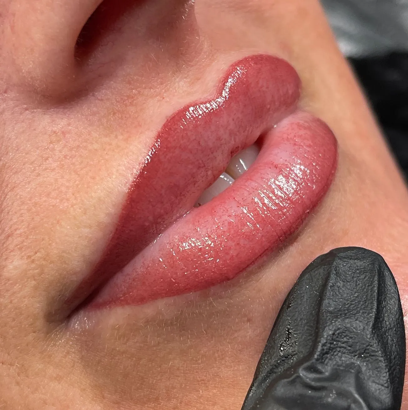 What Happens During the Ghosting Phase of Lip Blush